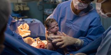 Grumpy child: Displeased newborn stares down doctors immediately after birth