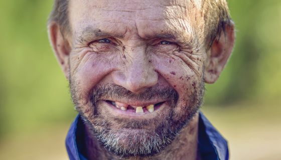 Tiger Saw A Man: Joe Exotic’s Husband John Finlay Has New Enamel, And He’s Almost Unrecognizable