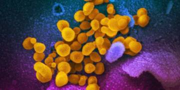Alberta has 1st presumptive case of coronavirus