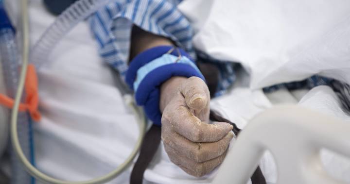 ‘Tip of the iceberg:’ Incomplete coronavirus data may understate true death toll