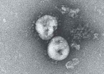 New coronavirus looks set to cause a pandemic  how do we control it?